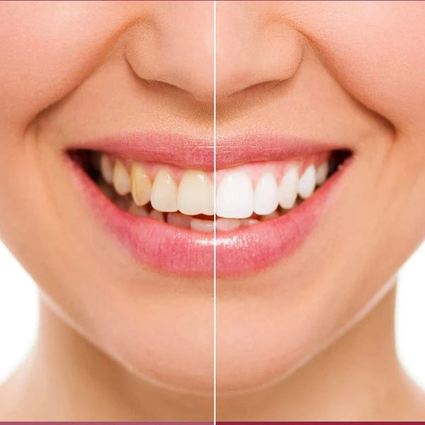 Probiotic Whitening Toothpaste